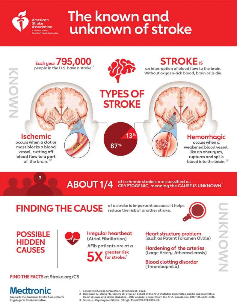 infographic example